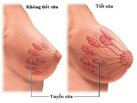 Đau nhũ hoa có phải dấu hiệu mang thai hay không?