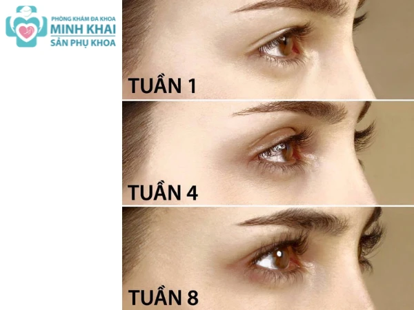 Mẹo vặt nhận biết dấu hiệu có thai hiệu quả